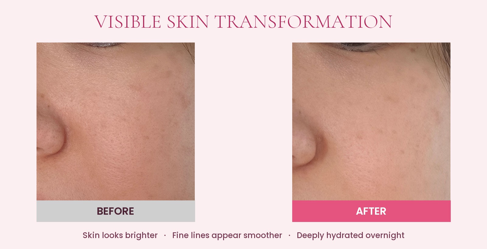 Before and after one overnight wear